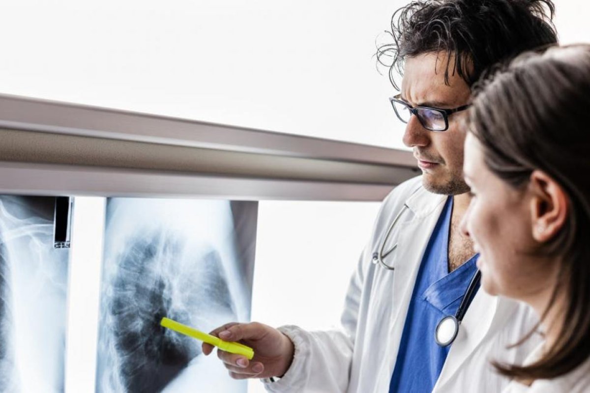 Cáncer de pulmón: cada 18' se pierde una vida debido a esta enfermedad