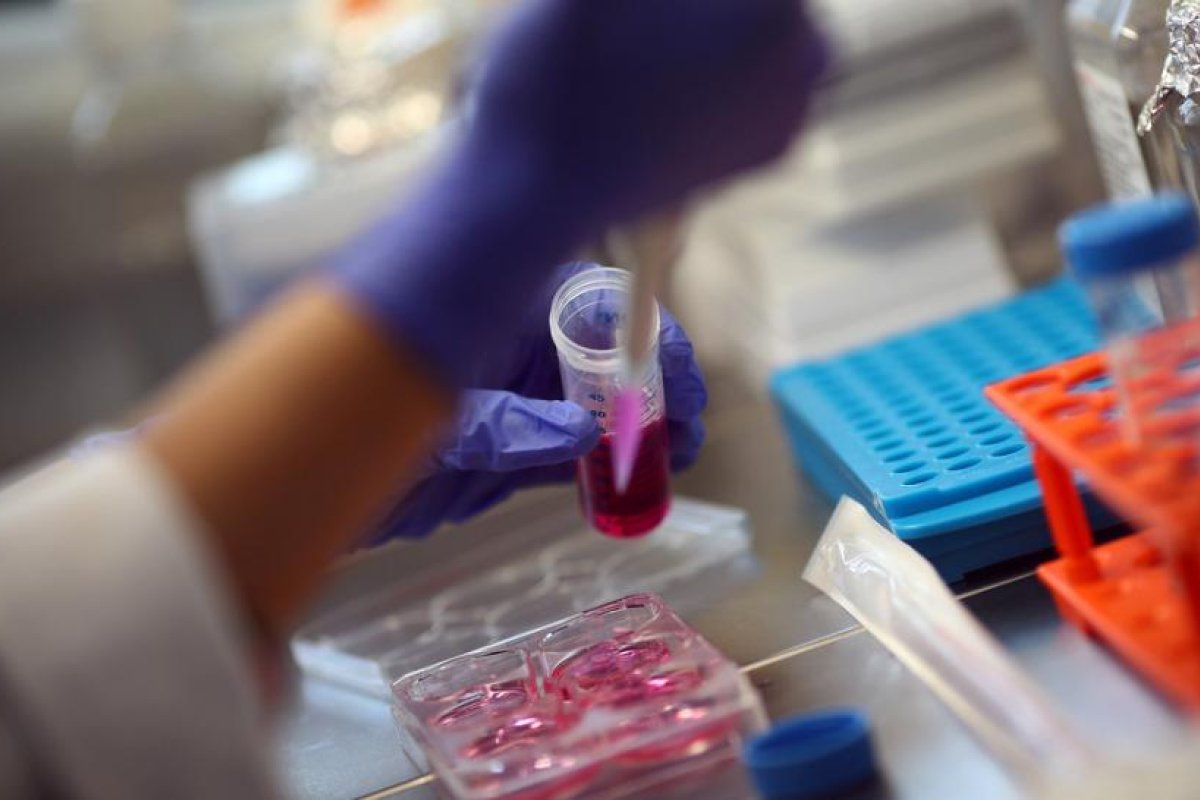 Científicos identifican unas células madre que regeneran los músculos hasta la vejez