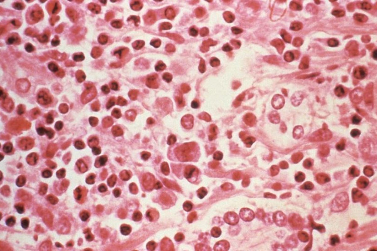 EE.UU.: Detectan un primer caso humano de hantavirus en el estado de Míchigan