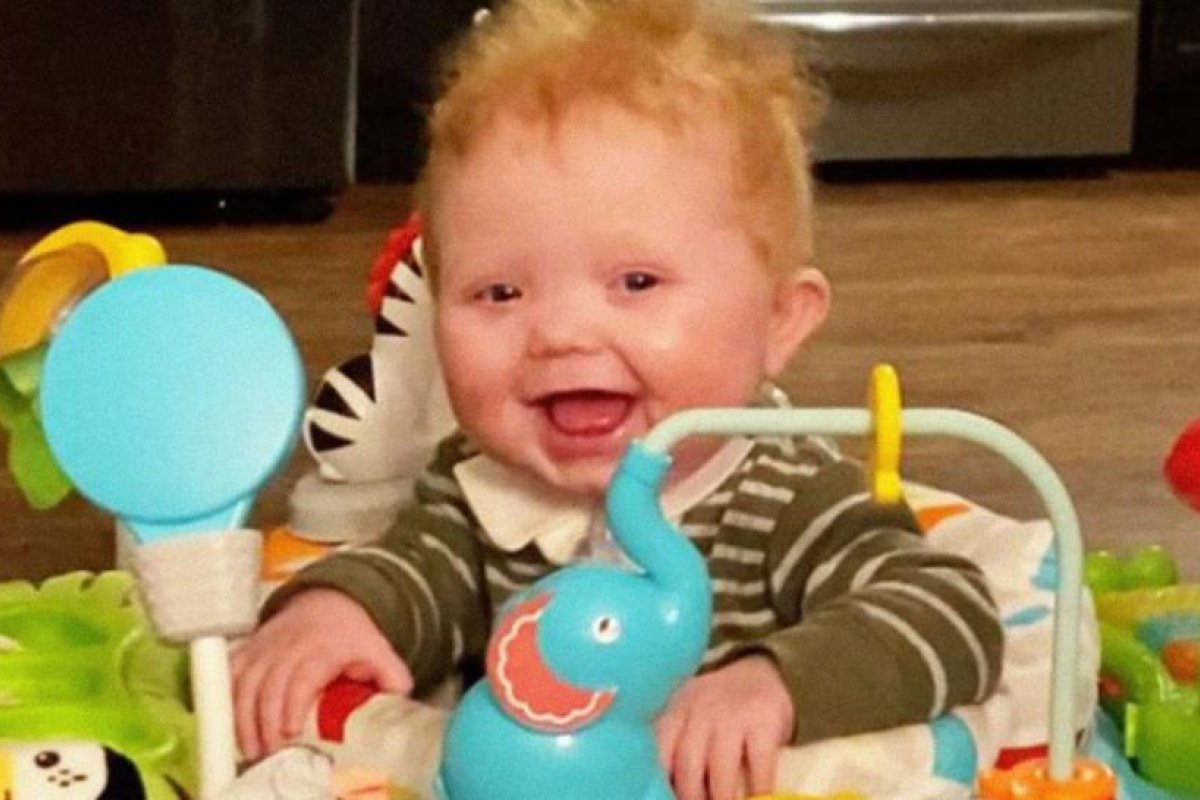 Un bebé de seis meses recibe el primer trasplante combinado de corazón y timo del mundo