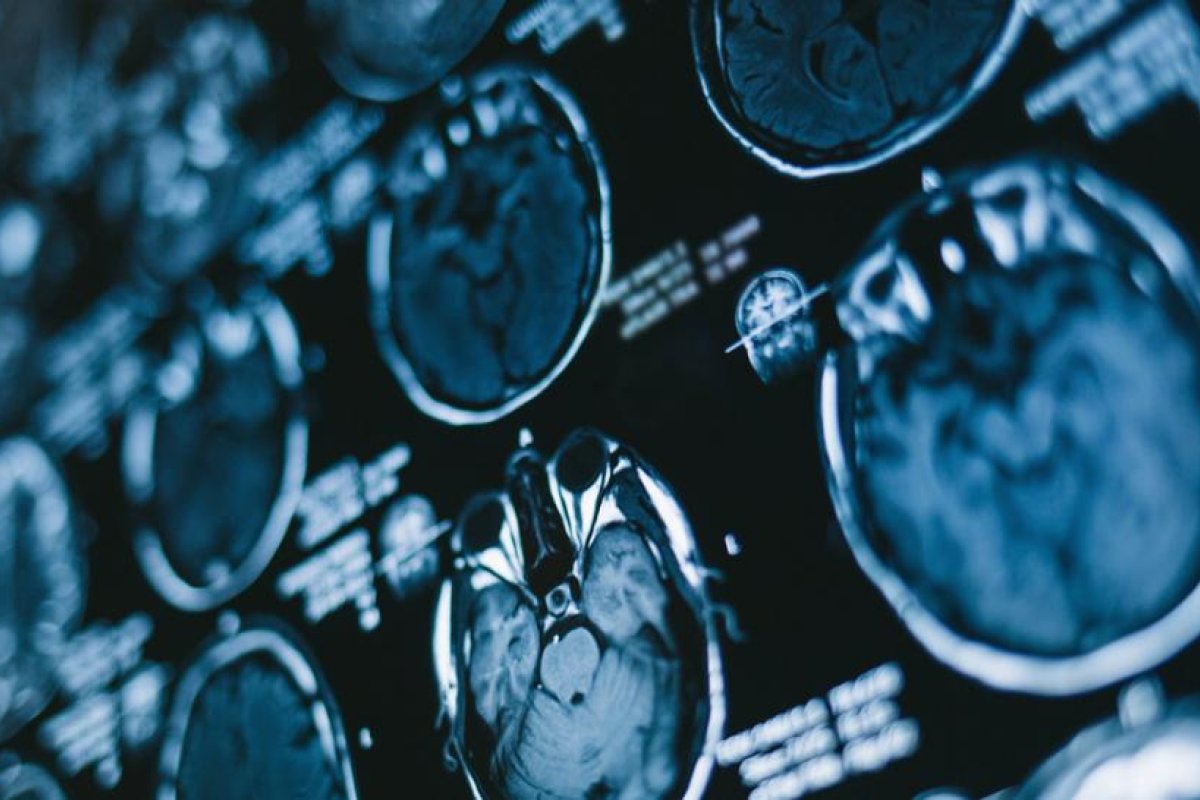 ¿Por qué la vida pasa frente a los ojos cuando estamos a punto de morir?: científicos descubren una posible respuesta al estudiar un cerebro moribundo