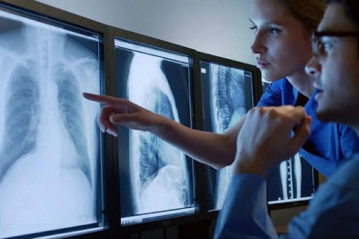 Día Mundial de la Radiología: cómo fue el experimento que permitió descubrir los rayos X