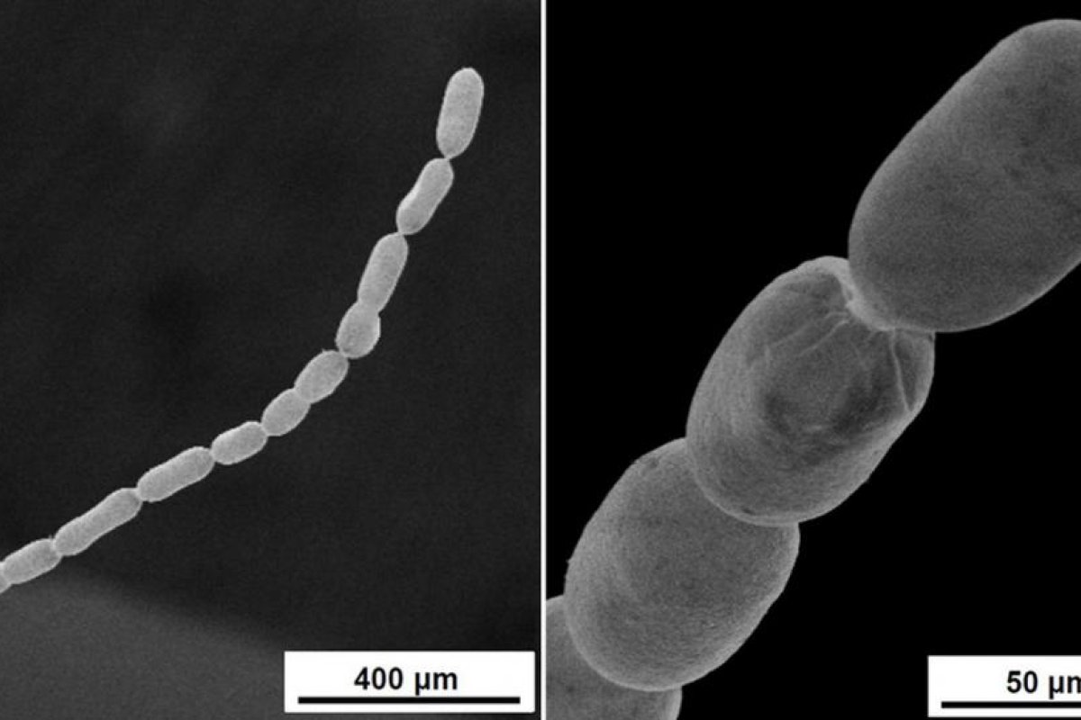 Descubren la bacteria más grande jamás conocida, que puede medir hasta dos centímetros de largo