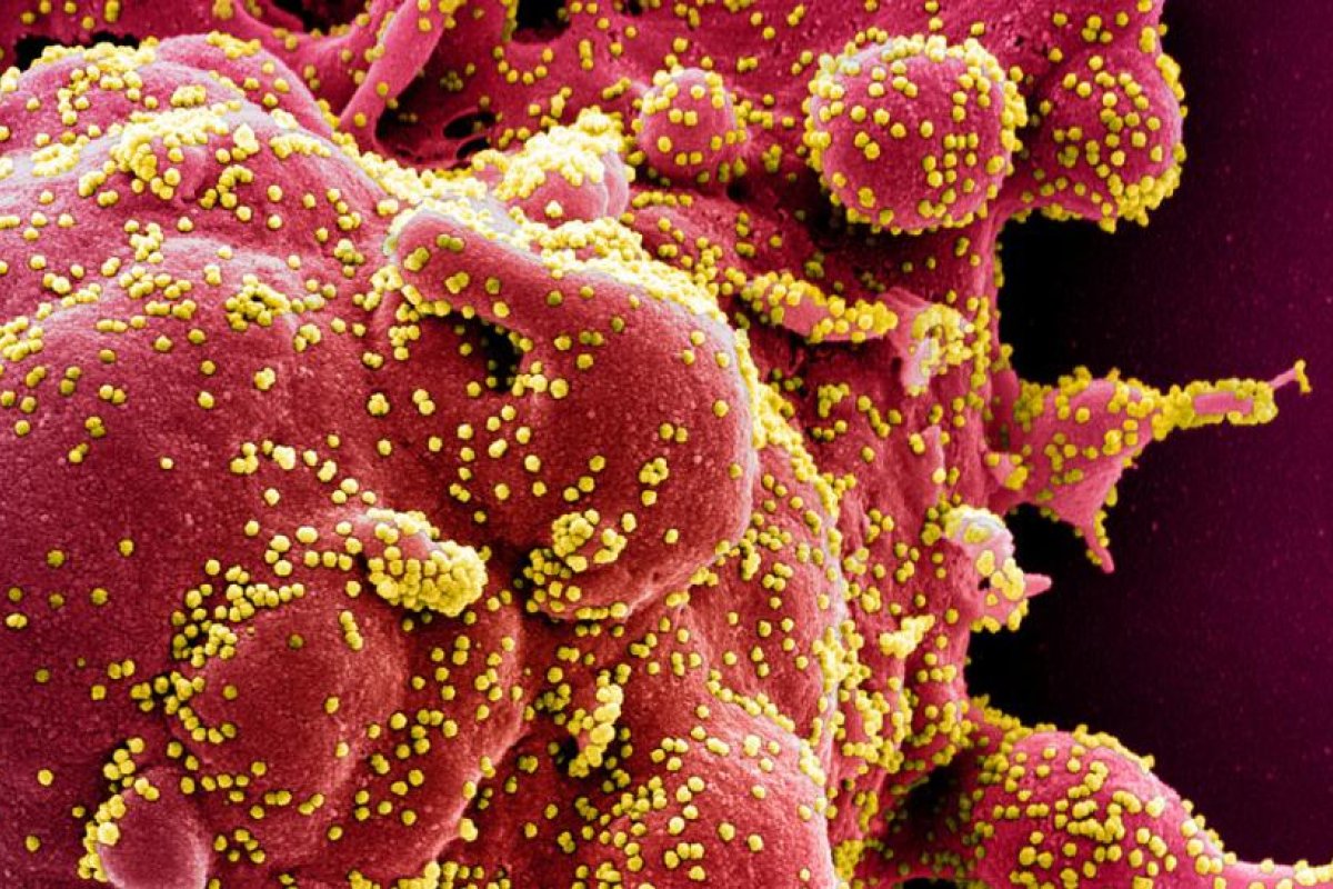 Localizan los talones de Aquiles de los coronavirus