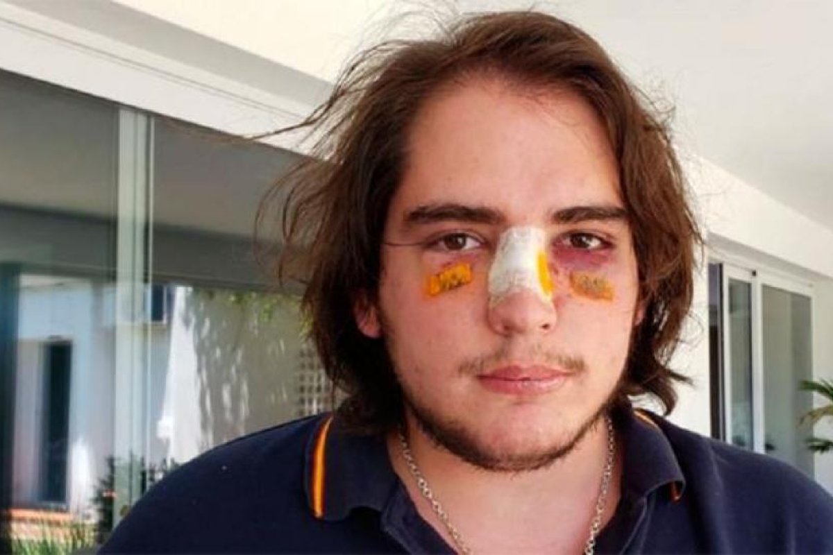 Imputaron a dos rugbiers por la brutal golpiza a un adolescente en Córdoba
