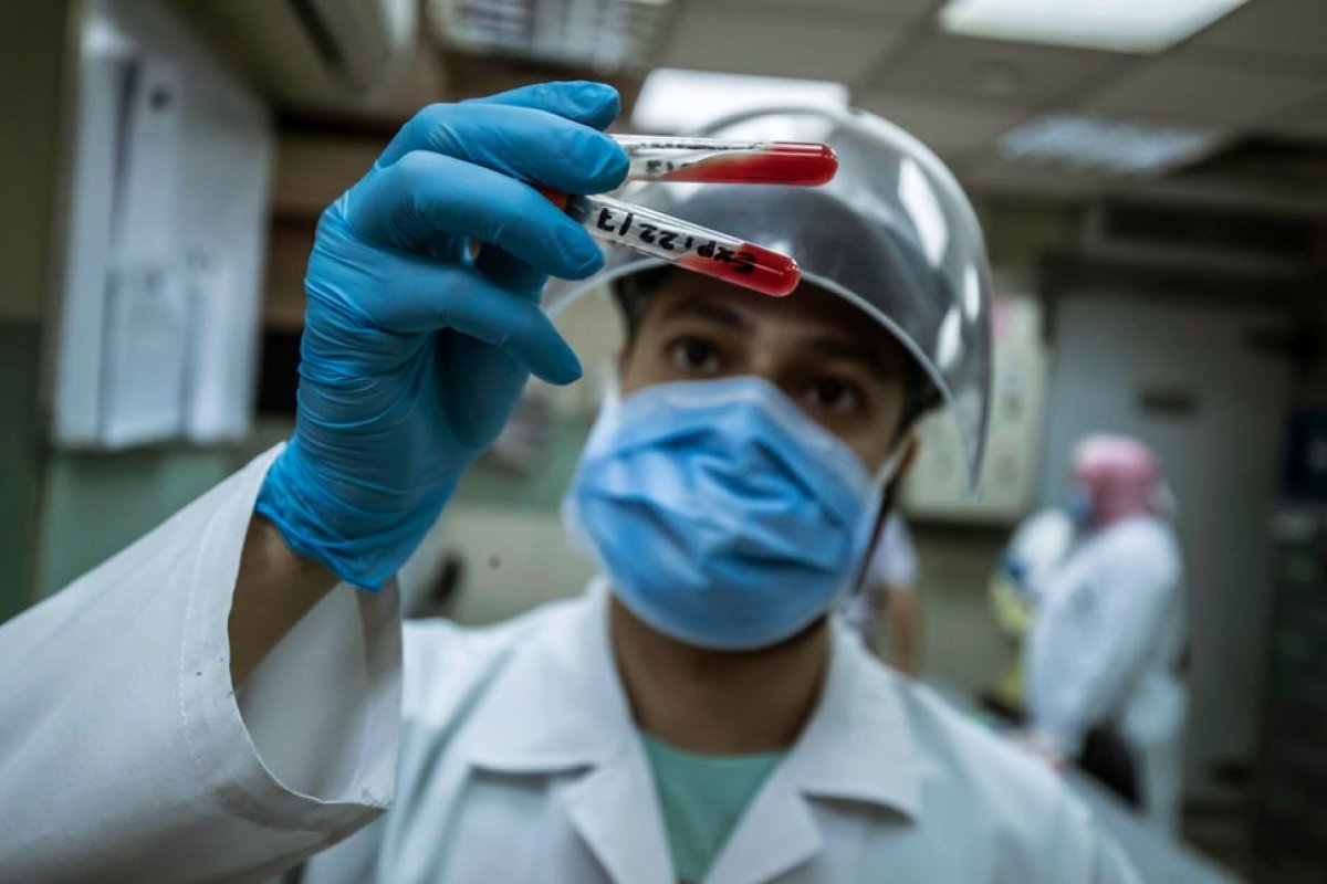 Coronavirus: hallan cinco genes claves en pacientes con Covid-19 severo
