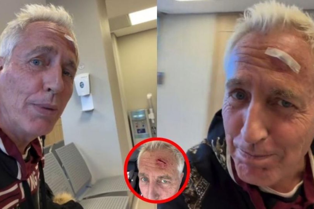 Marley sufre accidente en la cabeza y requiere atención médica urgente