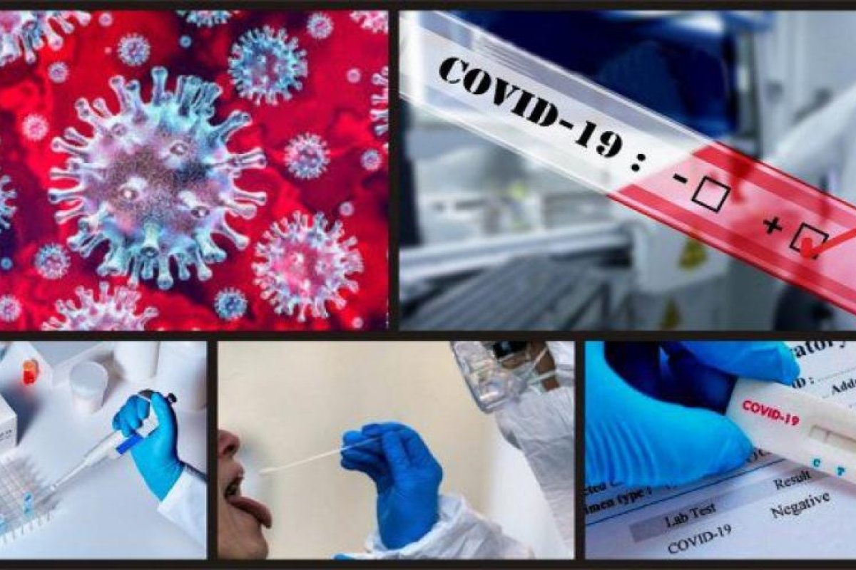 Covid-19: reactivos autorizados por la ANMAT y el Ministerio de Salud