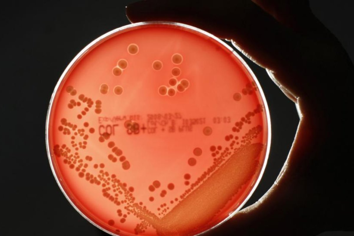 Un hombre se contagia con una bacteria 'comecarne' al rasurarse con una afeitadora ajena