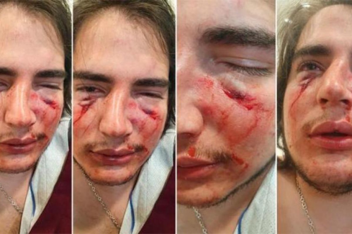 Córdoba: dos rugbiers fueron denunciados por golpear ferozmente a un joven